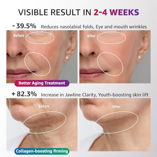 Aesthifae Red Light Therapy For Face And Neck Microcurrent Facial Device With Vibration Tech Gua Sha Facial Massager Tool With Thermals True Beauty Glow Facial Sculptor For Wrinkles Double Chin General