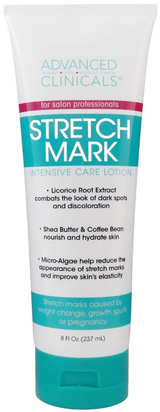 Advanced Clinicals Stretch Mark Lotion. Moisturizing Cream for Scars, Extreme Weight Loss, Pregnancy. 8oz Tube.