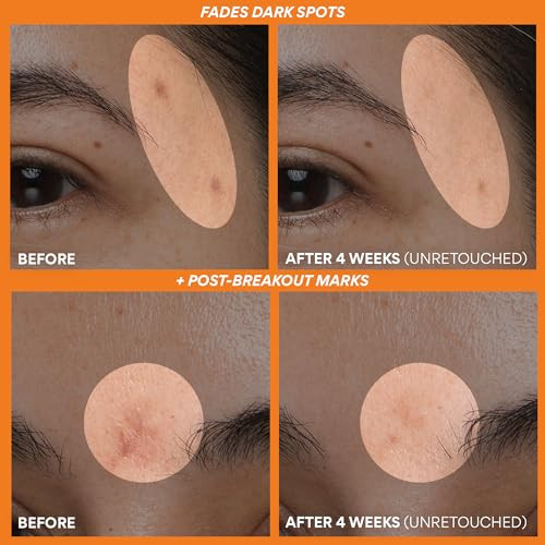 Innisfree X Steven Harrington Limited Edition Korean Beauty Vitamin C Green Tea