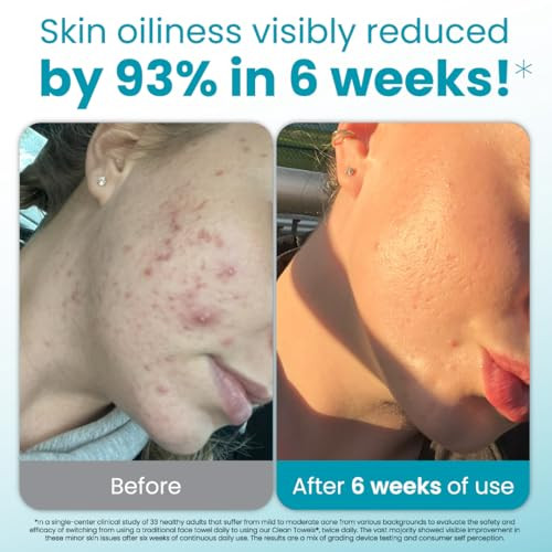 Clean Skin Club Blemish Control Clean Xl Travel Packface Light Exfoliation For Oily Skin Eczema Association Accepted Face Towel Tsaapproved Travel Essential 10 Countpack Of 1