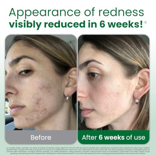Clean Skin Club Sensitive Skin Clean Xl Ultrasoft Disposable Face Dry Wipes Infused With Aloe And Glycerin Xl 50 Count 2 Pack