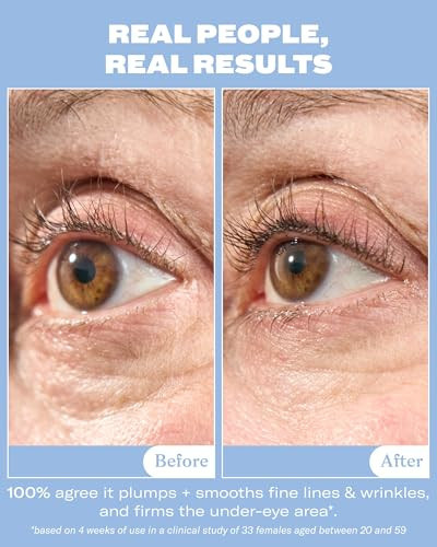 Then I Met You Snail Mucin Eye Cream Korean Skin Care With Volufilinefor Dark Circles Puffy Eyes And Wrinkles Hydrating Brightening And Firming Under Eye Cream With Peptides Collagen And Caffeine