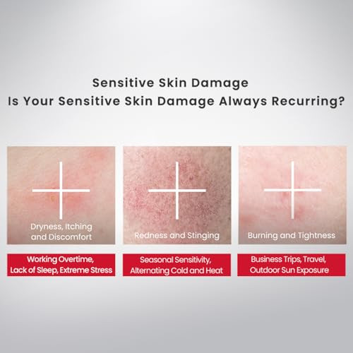 Winona Sensitiveness Relieving Moisturizing Toleranceextreme Cream Intense Hydration Soothes Dryness And Redness For Sensitive Skin1.76Oz