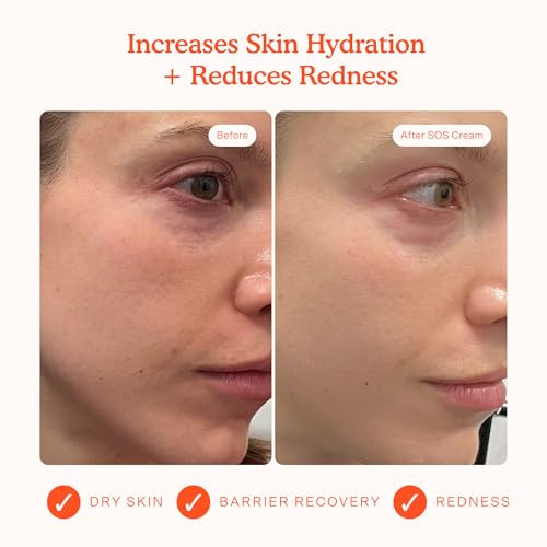 Tower 28 Sos Recovery Hydrating Face Cream For Sensitive Skin 1.86 Oz