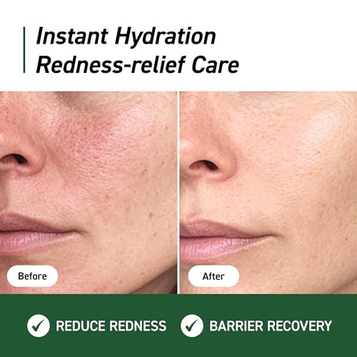 Ivoskin Cica Redness Relief Treatment Cream Soothing And Hydrating Green Correcting Moisturizer With Madecassoside Helps Repair Skin Barrier For Sensitive Skin Vegan Korean Skincare 1.76Oz 50G