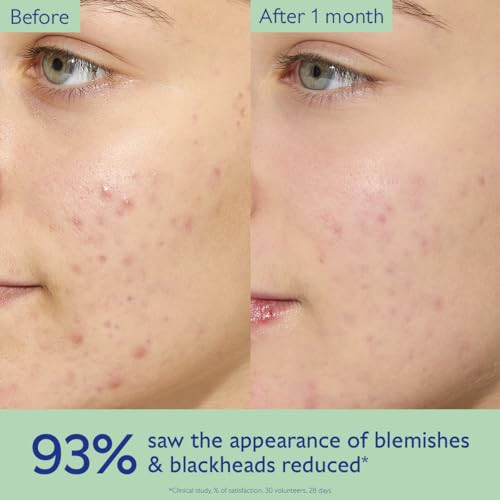 Caudalie Vinopure Oil Control Moisturizer For Acne Prone Skin 60 Mllightweight Mattifying Moisturizer To Hydrate Absorb Excess Oil And Reduce The Appearance Of Imperfections And Blackheads.