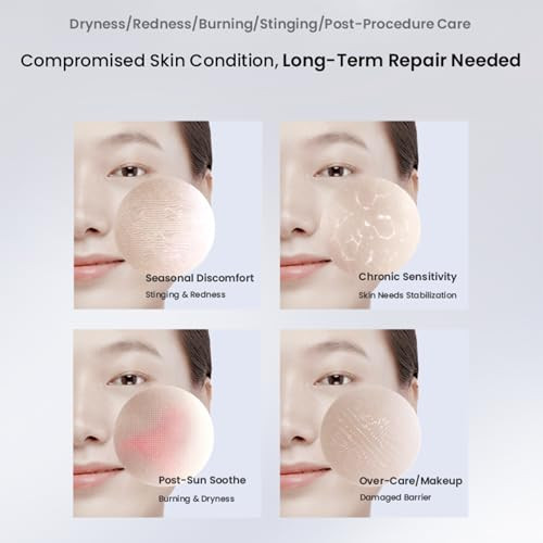 Winona Freezedried Facial Mask Soothing Essence For Sensitive Skin Moisturizing Soothing Improving Redness For Moderately Dry And Sensitive Skinmoisturizing Skincare 1Pc