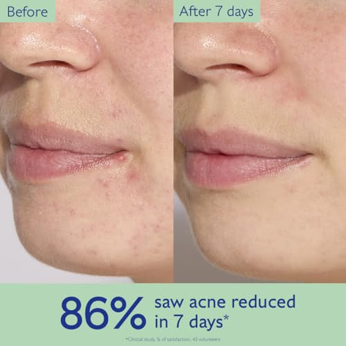 Caudalie Vinopure Acne Serum With Salicylic Acid 30 Mltargets All Types Of Acne While Helping Prevent Acne And Supports The Skin Barrier For Longlasting Results.