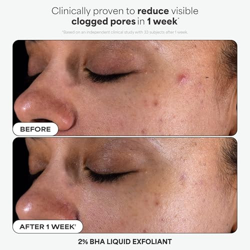 PaulaS Choice Paulas Choice Favorites Mini Kit 4 Piece Set Includes 2% Bha Exfoliant 1% Retinol Treatment 10% Azelaic Acid Booster Youth Extending Spf 50 Moisturizer Travel Skin Care Set For Glowing Skin