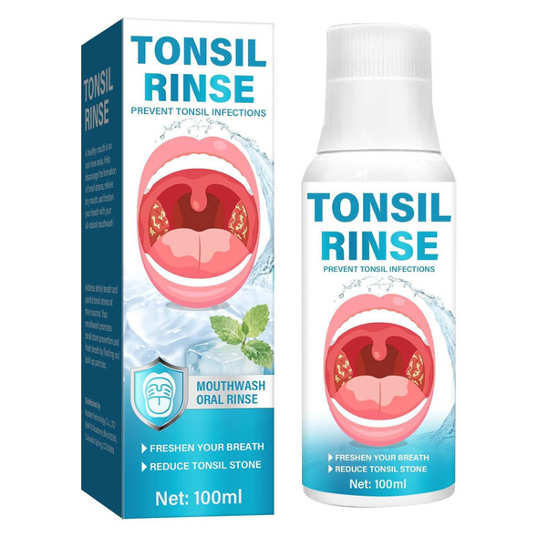 Young Living Tonsil Stone Mouthwashi1 4 AlcoholFree Natural Oral Rinse Gentle Soothing For Tonsil Area Reduce Residue & Bad Breath Mild Mint Flavor Daily Oral Hygiene Care