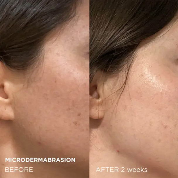 Dr. Brandt Microdermabrasion Age Defying Exfoliator 60g