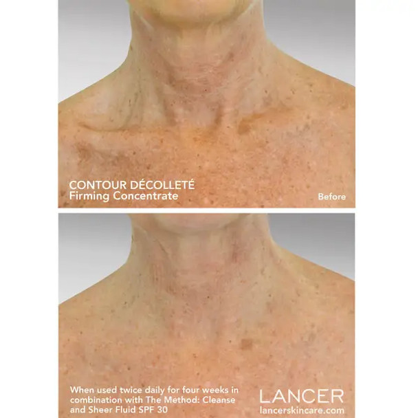 Lancer Skincare Contour Decollete 50ml