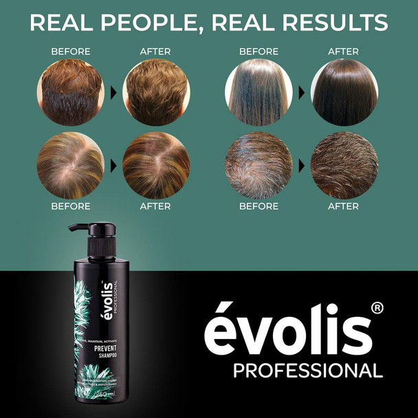 Evolis PREVENT Shampoo - Anti Hair Loss Shampoo - Hair Loss Shampoo for Men and Women - Natural Hair Loss Shampoo - Preventative Hair Loss Treatment (8.5 fl oz)