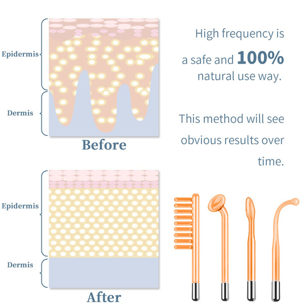 High Frequency Facial Machine - TUMAKOU Portable Handheld High Frequency Facial Skin Wand Machine with 4 Different Tubes