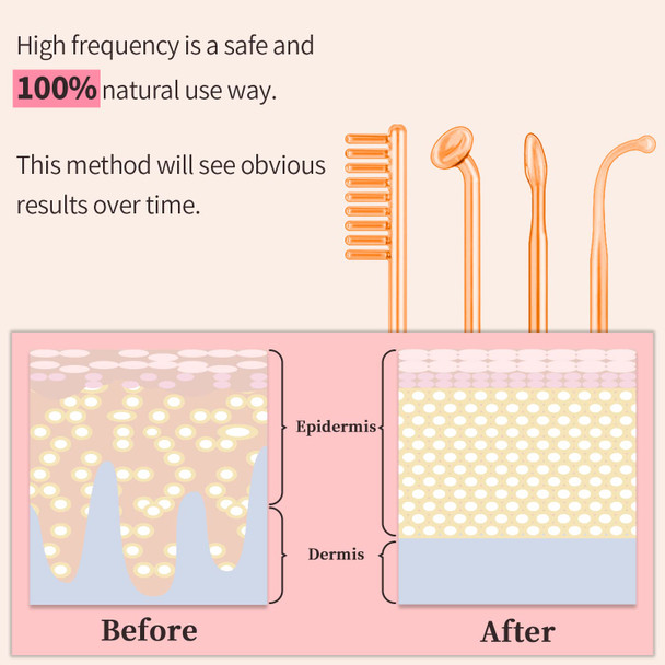 TUMAKOU Portable High Frequency Facial Machine - High Frequency Face Skin Wand Device