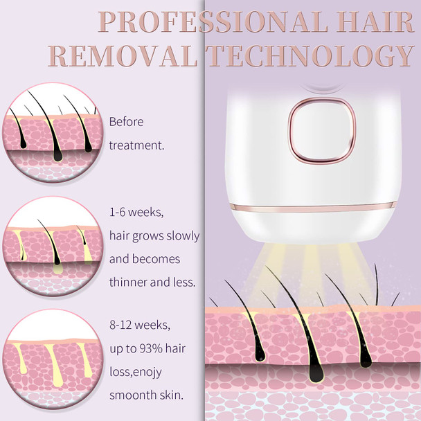 Permanent Hair Removal - TUMAKOU Facial Body Hair Removal Device for Women and Men - Upgrade 999,999 Flashes - Home Use Hair Remover for The Wholebody Use