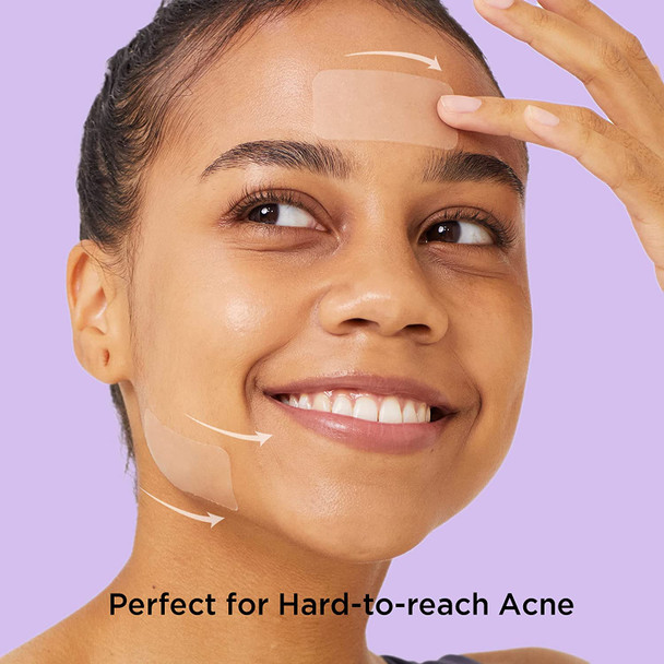 Avarelle Acne Cover Patch FIT (16 Count) Blemishes Patches, Acne Spot Treatment for Zit with Tea Tree, Calendula and Cica Oil for Face, Neck, & Back, Vegan, Cruelty Free (RECTANGULAR / 16 PATCHES)