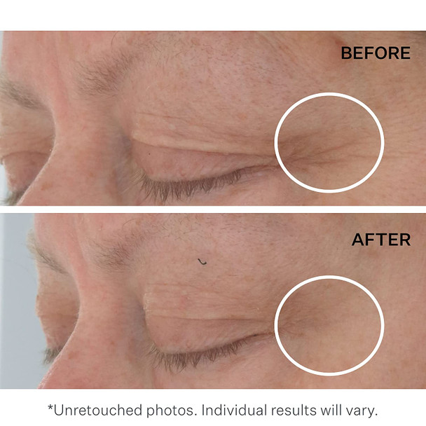 StriVectin Advanced Acids Hyaluronic Tripeptide Gel Cream for Eyes, Intense Hydration & Blue Light Neutralizer, 0.5 Fl Oz