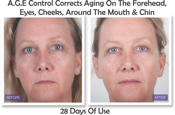 AGE Control Dual Treatment Anti Glycation Serum: Look 8-10 Years Younger In 60 Days. Reduce Discoloration & Dark Spots, Lifting, Firming, Brightening, Hydrating, Anti-Wrinkle, Non Greasy