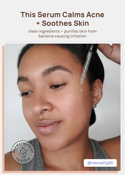 AOA Skin Blemish Clarifying Serum AOA Skin Blemish Clarifying Serum