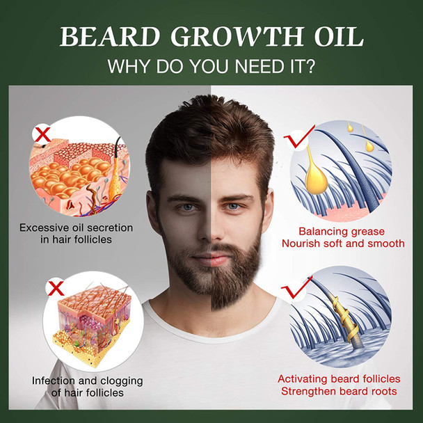 Beard Growth Oil with Biotin & Caffeine -Naturally Beard Growth Serum Promote Hair Regrowth,Full, Thick, Masculine Facial Hair Treatment for Men 30ml