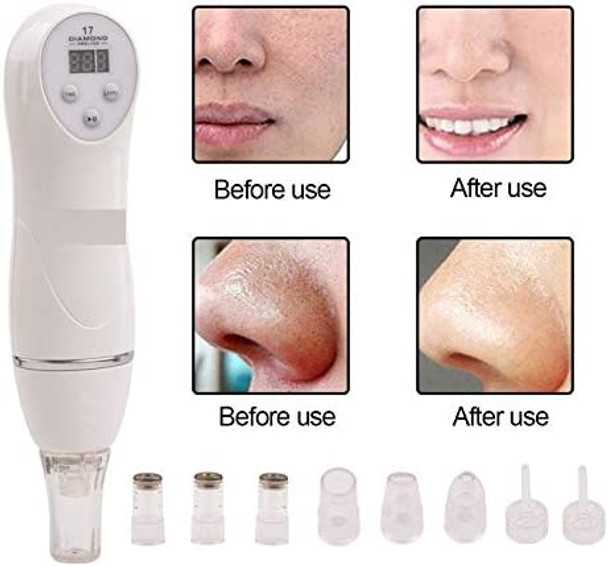 YAVOCOS 6 Tips Blackhead Vacuum Suction Remover Machine Mini Diamond 17 Dermabrasion Skin Peeling Digital Beauty Device Facial Pores Cleaner