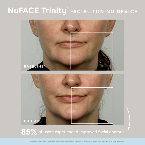 NuFACE Trinity Starter Kit – Microcurrent Facial Toning Device with Hydrating Leave-On Gel Primer, 2 Fl Oz