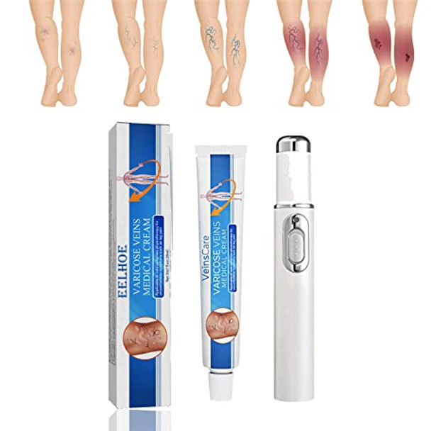 Veinshealth Varicose Veins Blue Light Therapy, Varicose Veins Cream With Veins Pen (1cream+1pen)