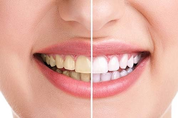 Natural Teeth Whitening Powder 2 Packs - Coconut Activated Charcoal - Effective Teeth Whitener + 2 Packs Bamboo Toothbrush + Tips, Tricks & Benefits Electronic Book