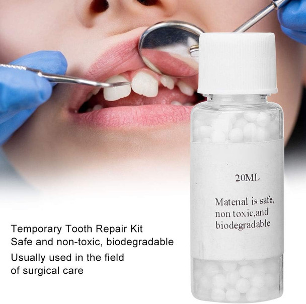 Temporary Tooth Repair Kit, Temporary Broken Teeth Repair, Moldable Thermal Fitting Beads for Missing Broken Teeth Dental Tooth Filling Material(20ml)