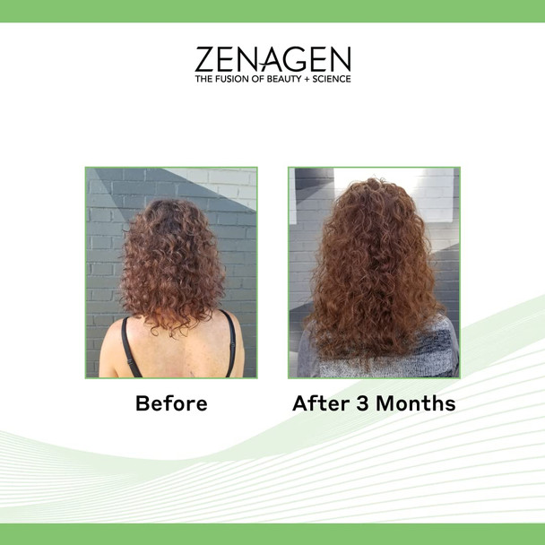 Zenagen Evolve Unisex Treatment