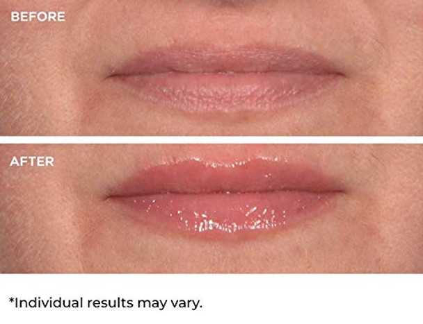 NassifMD Hydro-Screen for Lips