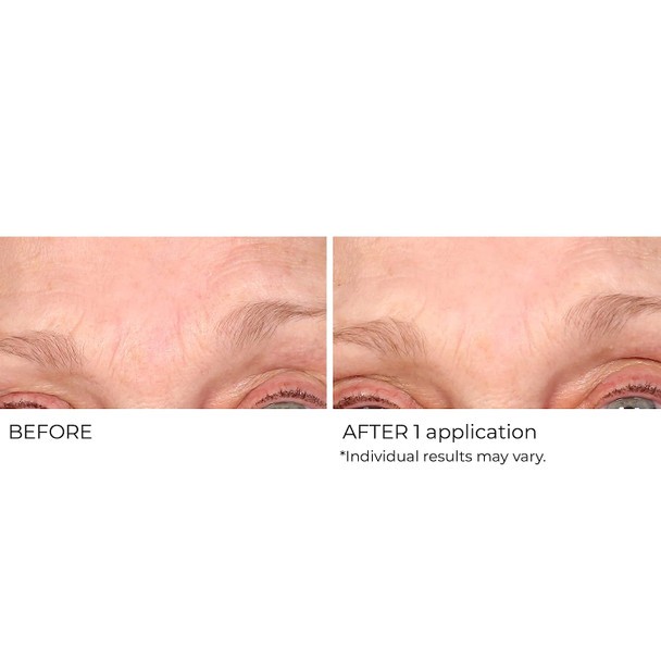 NASSIFMD Wrinkle Blur Targeted Treatment