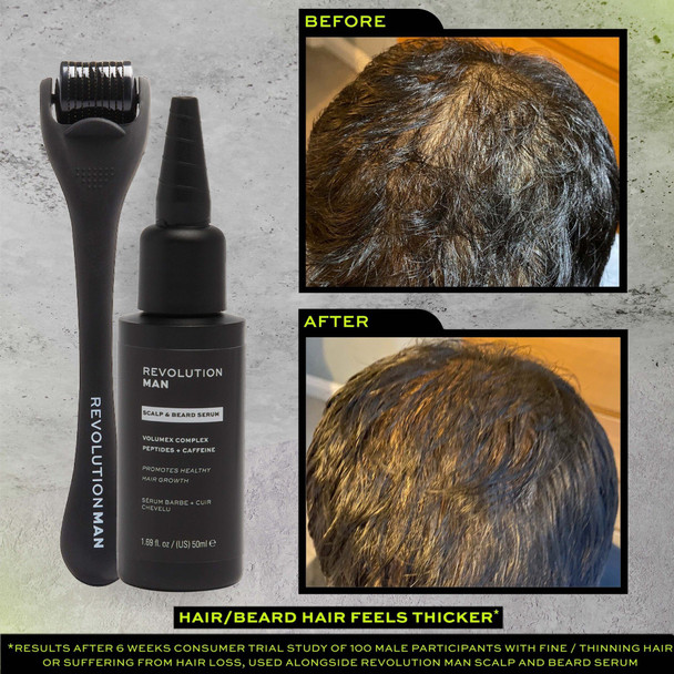 Revolution Man Beard & Scalp Derma Roller