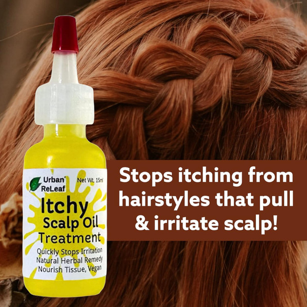 Urban ReLeaf Itchy Scalp Oil Treatment ! Braids, Wigs, Weaves, Tight & Itchy Skin Relief, Quickly Stops Irritation, Natural Herba