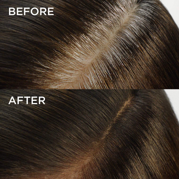 L'Oreal Paris Root Rescue Dark Blonde 7 2Pk