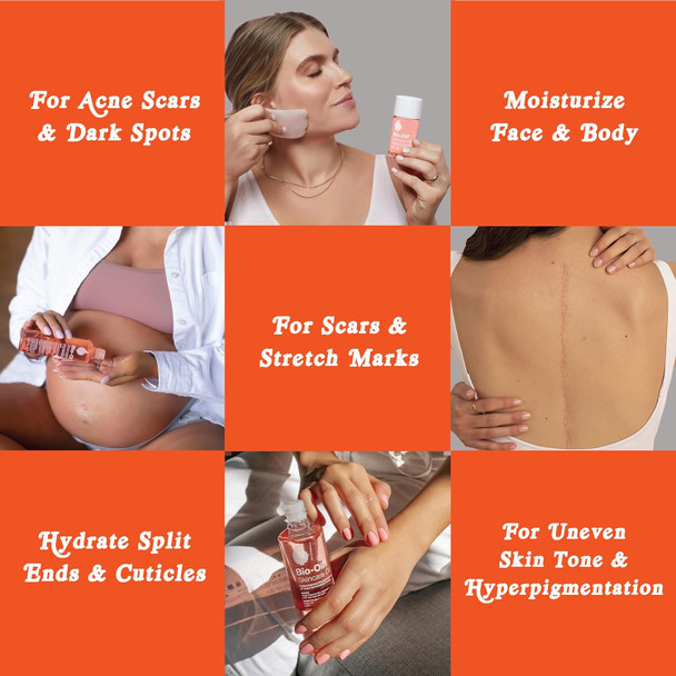 Bio-Oil Skincare Body Oil Vitamin E Serum For Scars & Stretchmarks Face & Body Moisturizer 2 Oz All Skin Types (Pack Of 24)