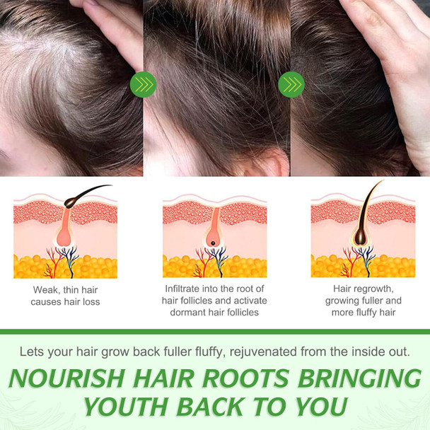 Elbbub 100% Pure Rosemary Essential Oil for Skin Care & Stimulates Hair Growth for Men Women -60ml Nourishes The Scalp Versatile Usage for Eyebrow and Eyelash Elbbub 100% Pure Rosemary Essential Oil for Skin Care & Stimulates Hair Growth for Men Women -60ml Nourishes The Scalp Versatile Usage for Eyebrow and Eyelash