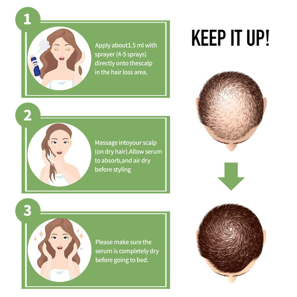 Elbbub Hair Growth Serum - Hair Growth Oil for Thicker & Healthier HairReduces Hair Shedding with Biotin and Advanced Topical Formula