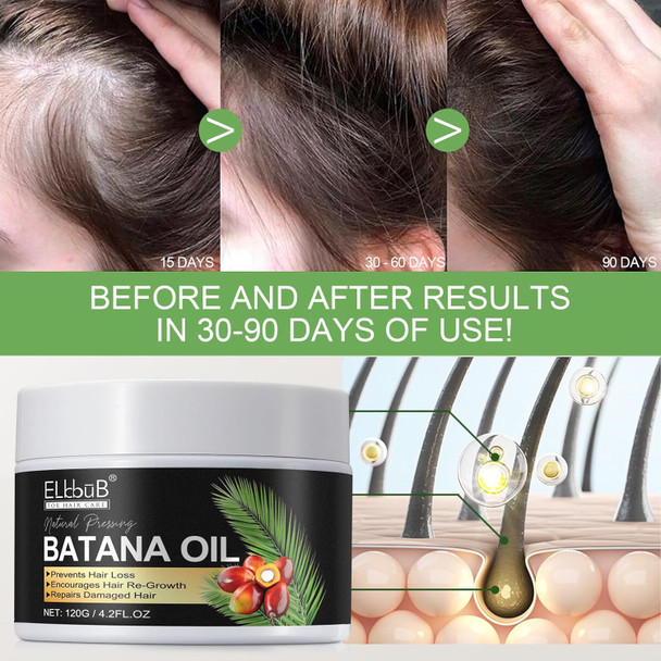 Elbbub Raw Batana Oil for Hair Growth and Repair -100% Pure Unrefined Oil from Honduran Rainforests Prevent Hair Loss and Enhances Hair Thickness in Men & Women Elbbub Raw Batana Oil for Hair Growth and Repair -100% Pure Unrefined Oil from Honduran Rainforests Prevent Hair Loss and Enhances Hair Thickness in Men & Women
