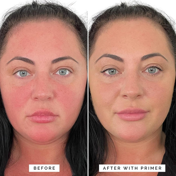 Elizabeth Mott Thank Me Later Color Correcting Face Primer (30G) & Elizabeth Mott Hydrating Face Serum (100Ml)