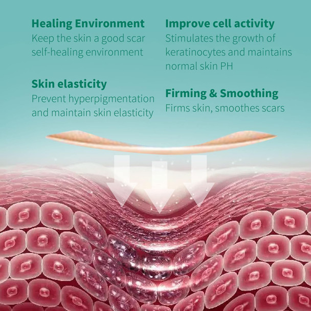 Silicone Scar Tape 1.6"X 60" Reusable Silicone Sheet For Scar Away Treatment Stretch Mark Removal Tattoo Cover Up Painless Scar Removal For Surgery, C Section, Acne, Keloid