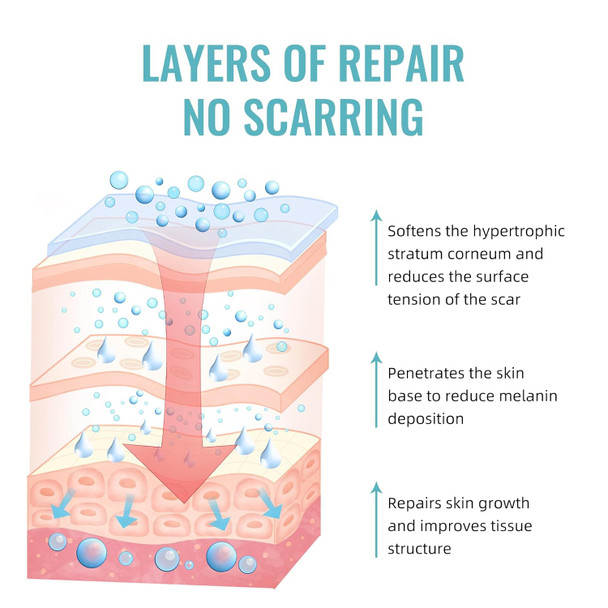 Scar Gel Advanced Scar Treatment, Silicone Scar Gel Scar Removal Scar Cream Gel Silicone Gel Scar Gel For Face C-Section Tummy Tuck Keloid And Surgical Scars Burns Old Scars Deep Acne Scar Removal