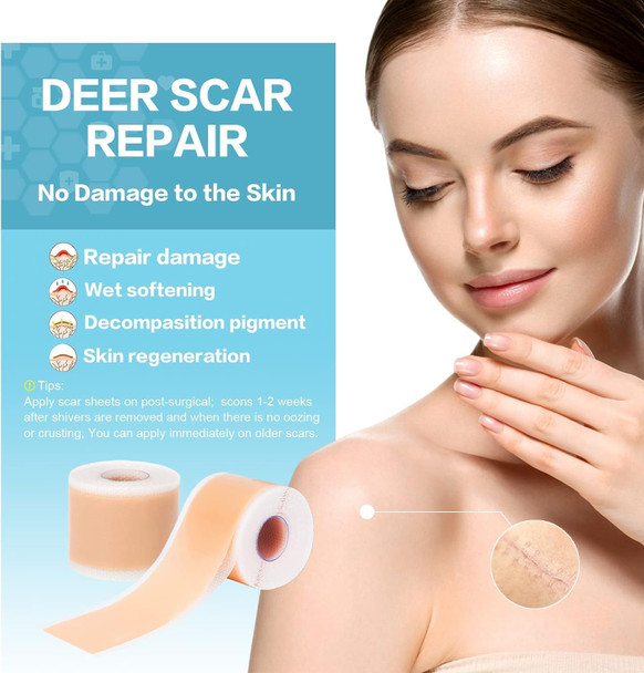 Silicone Scar Sheets (1.6”X120”Roll-3M), 1 Roll Medical Grade Washable Silicone Scar Tape, Reusable Scar Removal Sheets For C-Section, Surgery, Burn, Keloid, Acne