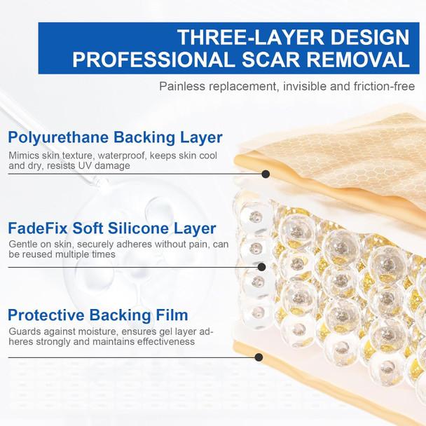 Silicone Scar Sheets,Silicone Scar Tape,Scar Tape For Surgical Scars,C-Section,Tummy Tuck,Keloid Bump Removal (1.6"X 19.7", 3 Rolls-Total 1.5M, Three-In-One Version, Pink/Beige/Clear)