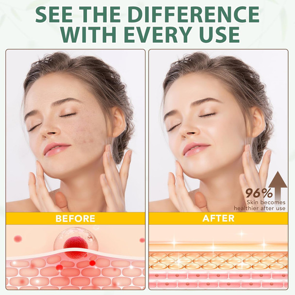 Beef Tallow For Face, Tallow Face Moisturizer, 4.2 Oz Organic Whipped Grass Fed Beef Tallow With Honey Cream For Face & Body, Unscented