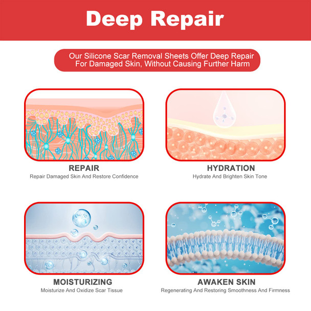 Silicone Scar Sheets - 5.9"X2.4" Extra-Large For Enhanced Coverage, Pack Of 8 - Comfortable, Effective For Acne, Post-Surgery Scars, Hypertrophic, Keloid, Tummy Tucks