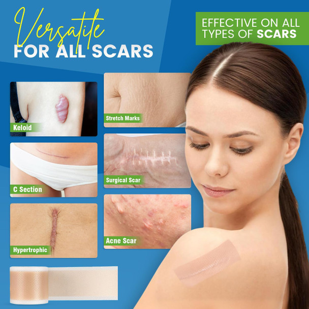 Silicone Scar Tape,Silicone Scar Sheet (1.6” X 60” Roll, 1.5M) Scar Removal Strips For Surgical Scars,Keloids, C-Section, & Burns Tummy Tuck– Effective Scar Treatment For Faster Healing Reusable Tape