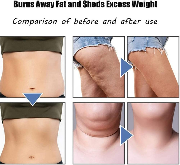 Ems Neck Acupoints Lymphvity Massager Device, Lymphatic Drainage Machine, 12 Modes Ems Neck Massager For Pain Relief, Portable Neck Lymphatic Massager For Women Men (A)