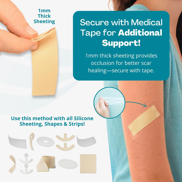 Newgel+ Advanced Silicone Scar Treatment Sheeting For Old And Scars, For Surgery, Injury, Keloids, C-Section, Burns, And Acne, Reusable, 1" X 6" Sheet (4 Count) - Beige